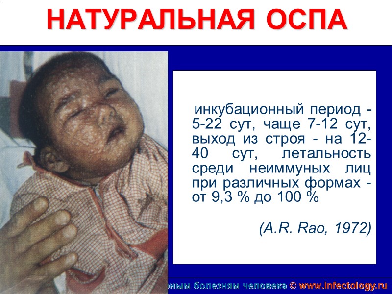 НАТУРАЛЬНАЯ ОСПА            